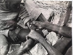 Ethnic Osteopathy